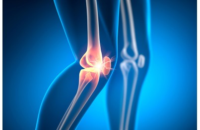 Il ginocchio: patologie e soluzioni Il ginocchio: patologie e soluzioni